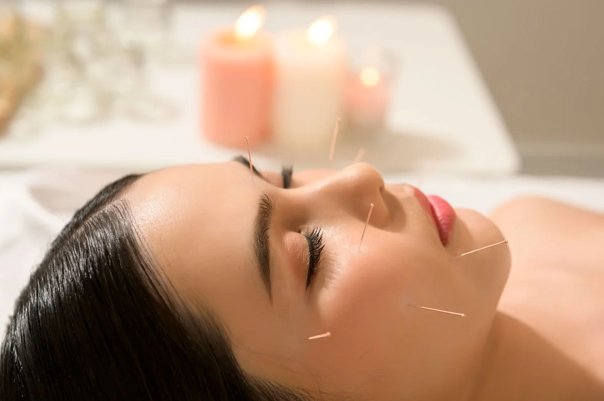 Cosmetic acupuncture facial rejuvenation in Boca Raton